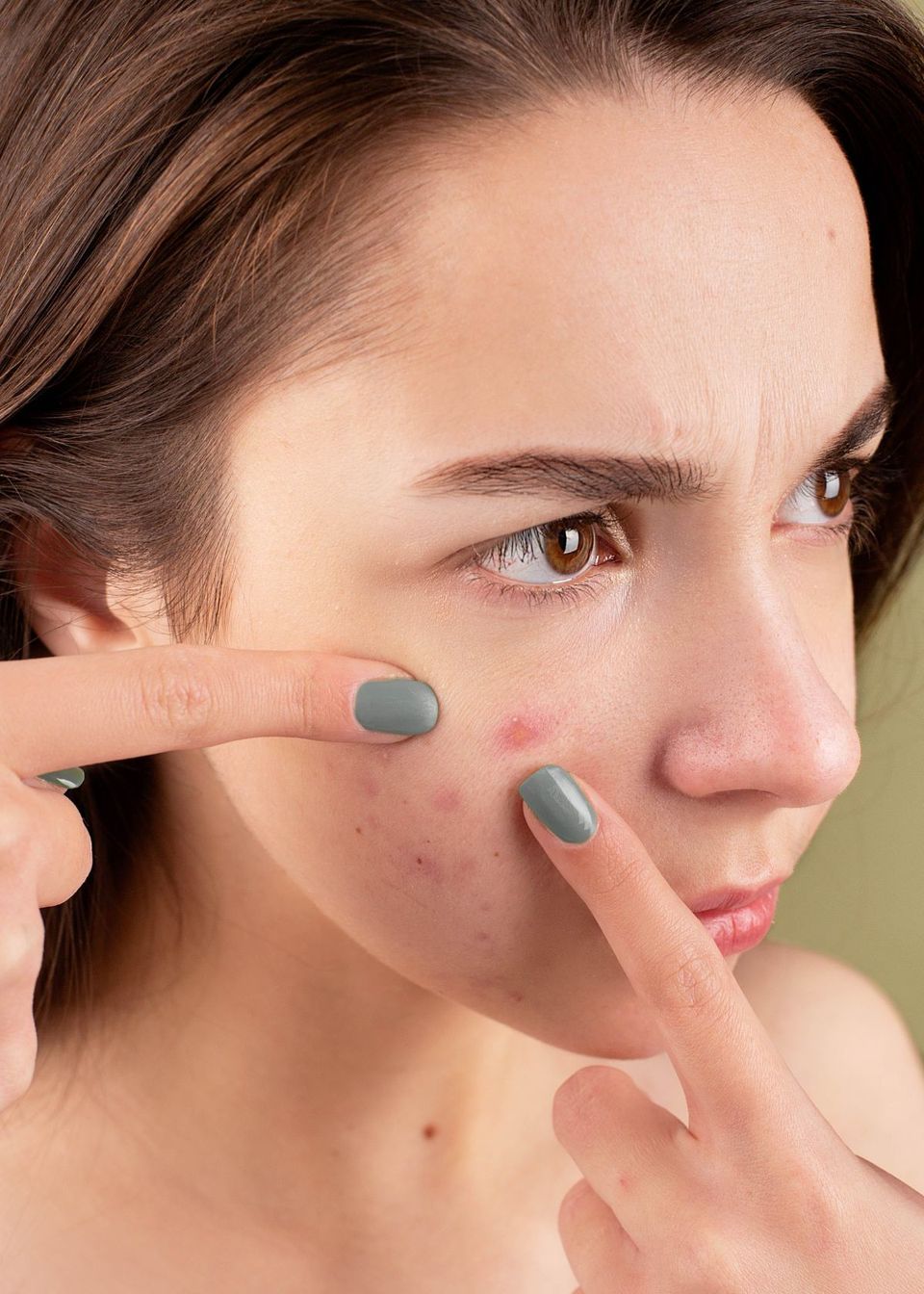 Pimple Patch to make your facial care easy